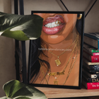 Golden Smile